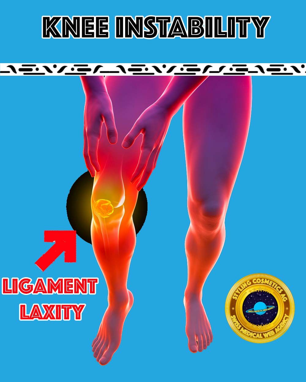Knee Instability