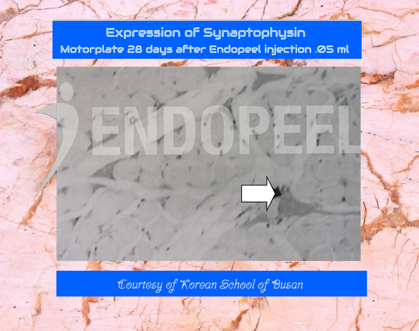 Synaptophysin-related experimental observation after Endopeel treatment