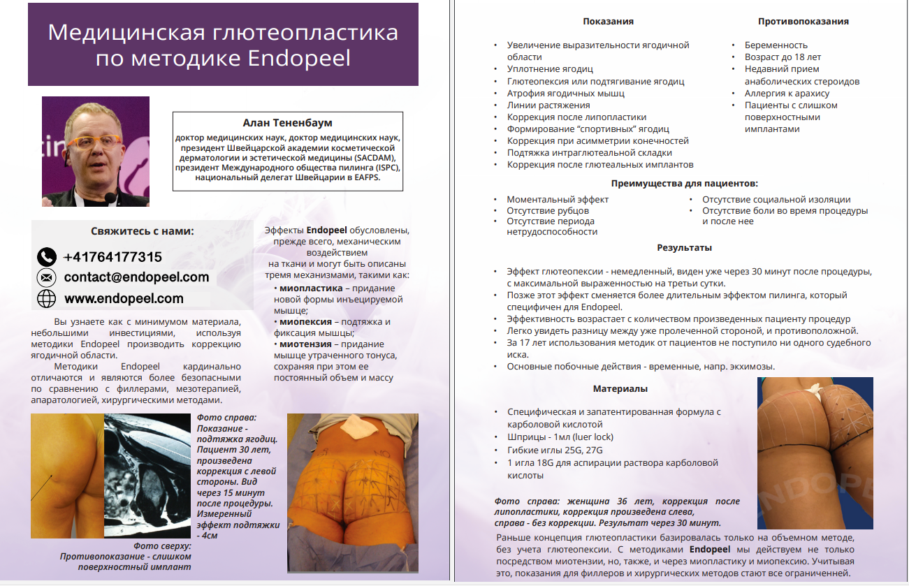 gluteoplasty-endopeel-RUS